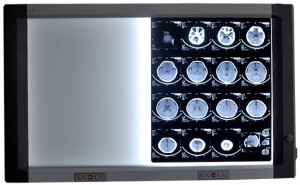 醫用LED雙聯觀片燈